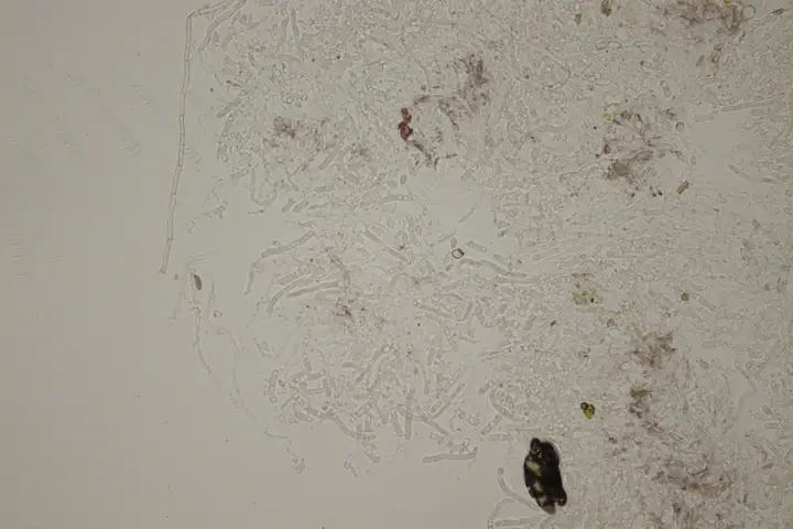 Płaskolepek odchodowy (Cystobasidium fimetarium)